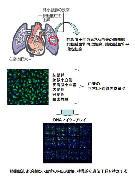 肺高血圧症の病態解明