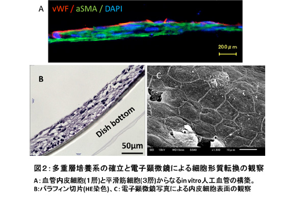 動脈硬化の進行の様子