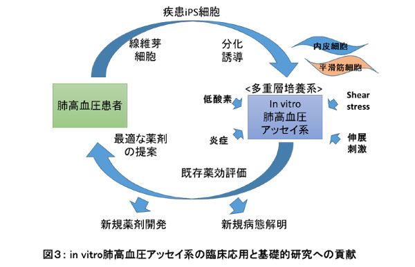 動脈硬化の進行の様子