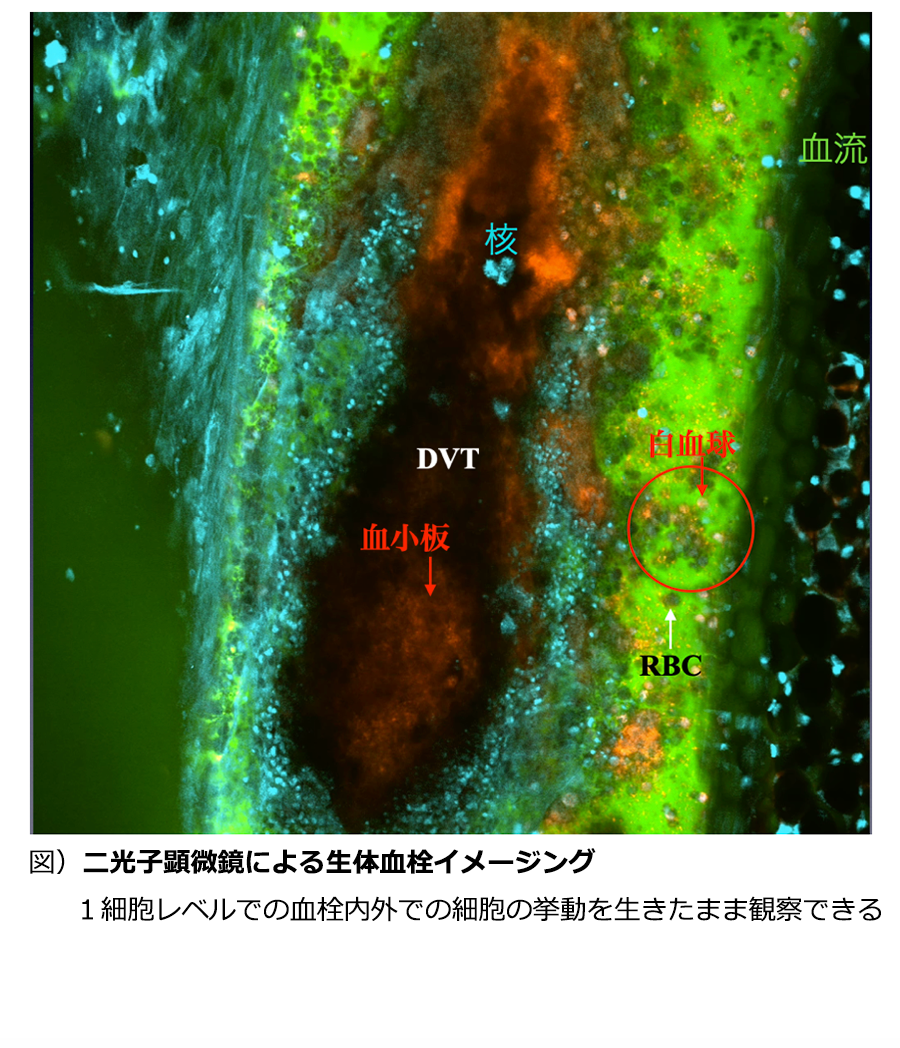 二光子顕微鏡による生体血栓イメージング