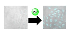 細胞内微量亜鉛の蛍光イメージング