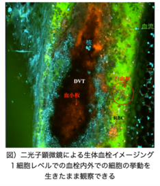 我々は独自に開発した生体血栓イメージングモデルを用いて、血栓の病態を生体下に１細胞レベルで可視化することに成功しました（図）。この手法を用いて血栓の形成から器質化に至る過程を解明を目指します。