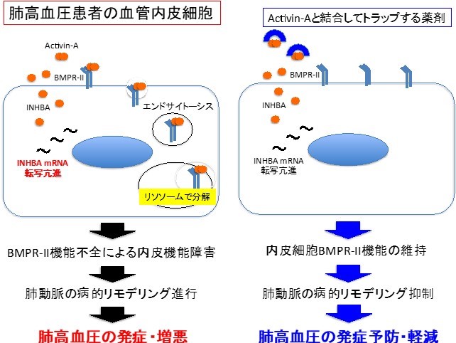 【プレスリリース】肺高血圧症の新しい病態メカニズムの発見（臨床薬学研究室）