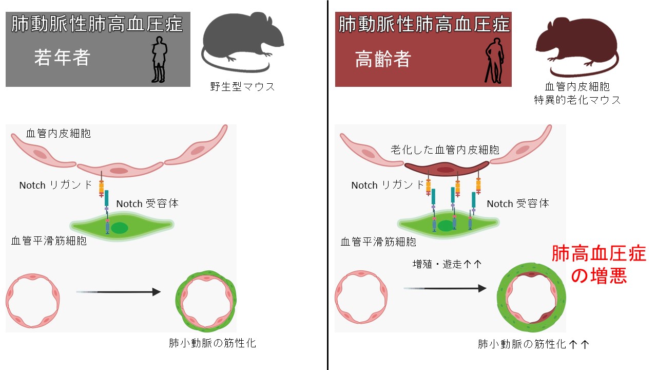 【プレスリリース】血管老化が肺高血圧症を増悪させる新しいメカニズムの発見(臨床薬学研究室)