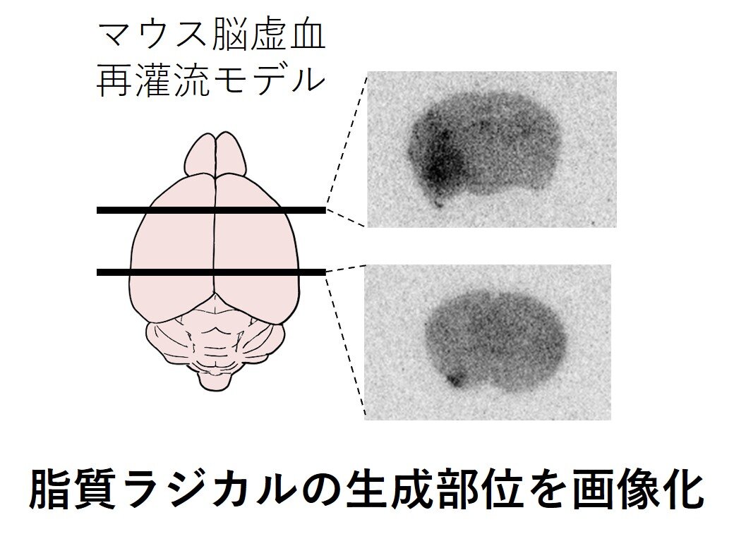 【プレスリリース】脳虚血再灌流障害で産生する脂質ラジカルの検出(薬品物理化学研究室)