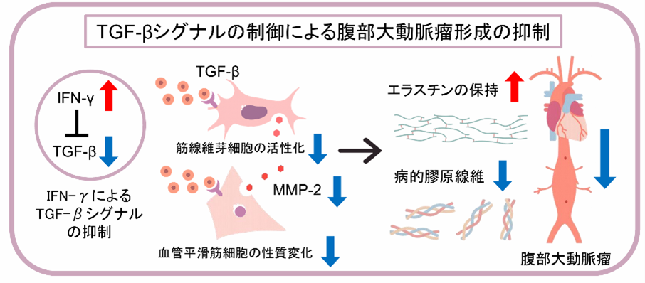 【プレスリリース】腹部大動脈瘤の発症・進展の抑制に関わる免疫機序を解明（医療薬学研究室）